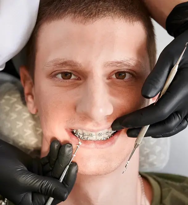 Orthodontic Treatment